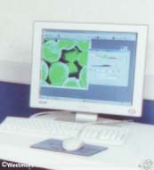 view sreen Electron microscope